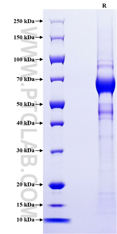 Purity of Recombinant Mouse PON2 was determined by SDS-PAGE. The protein was resolved in an SDS-PAGE in reducing (R) conditions and stained using Coomassie blue.