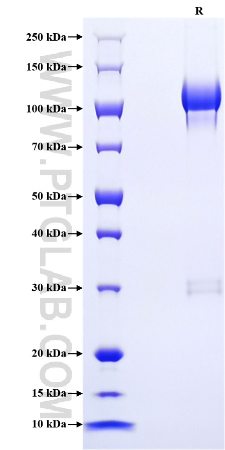 Purity of Recombinant Mouse Uromodulin was determined by SDS-PAGE. The protein was resolved in an SDS-PAGE in reducing (R) conditions and stained using Coomassie blue. Purity of Recombinant Mouse Uromodulin was determined by SDS-PAGE. The protein was resolved in an SDS-PAGE in reducing (R) conditions and stained using Coomassie blue.