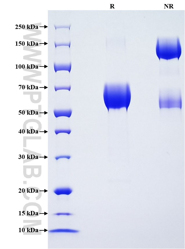 Purity of Recombinant Mouse ORM1 was determined by SDS-PAGE. The protein was resolved in an SDS-PAGE in reducing (R) and non-reducing (NR) conditions and stained using Coomassie blue.