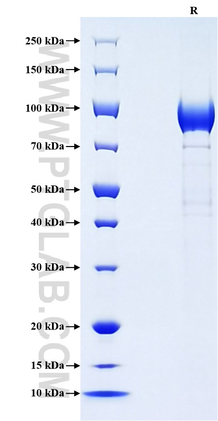 Purity of Recombinant Mouse LCAT was determined by SDS-PAGE. The protein was resolved in an SDS-PAGE in reducing (R) conditions and stained using Coomassie blue.