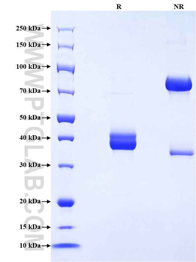 Purity of Recombinant Mouse Galanin was determined by SDS-PAGE. The protein was resolved in an SDS-PAGE in reducing (R) and non-reducing (NR) conditions and stained using Coomassie blue. Purity of Recombinant Mouse Galanin was determined by SDS-PAGE. The protein was resolved in an SDS-PAGE in reducing (R) and non-reducing (NR) conditions and stained using Coomassie blue.