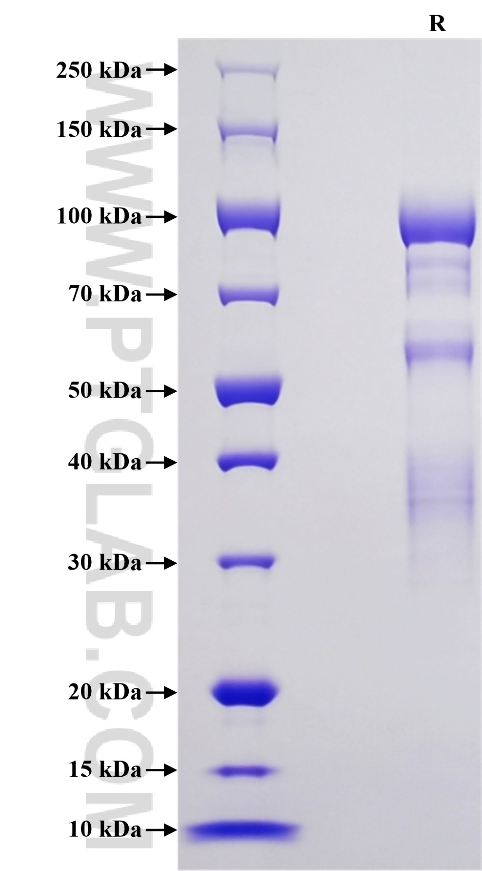 Purity of Recombinant Human Elastin was determined by SDS-PAGE. The protein was resolved in an SDS-PAGE in reducing (R) conditions and stained using Coomassie blue. Purity of Recombinant Human Elastin was determined by SDS-PAGE. The protein was resolved in an SDS-PAGE in reducing (R) conditions and stained using Coomassie blue.