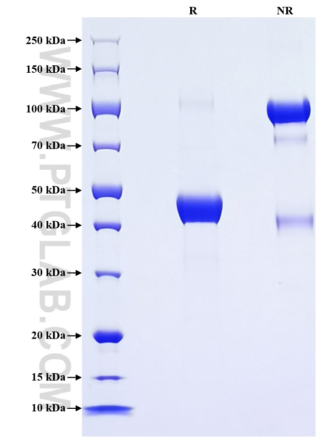 Purity of Recombinant Mouse CXCL15 was determined by SDS-PAGE. The protein was resolved in an SDS-PAGE in reducing (R) and non-reducing (NR) conditions and stained using Coomassie blue. Purity of Recombinant Mouse CXCL15 was determined by SDS-PAGE. The protein was resolved in an SDS-PAGE in reducing (R) and non-reducing (NR) conditions and stained using Coomassie blue.