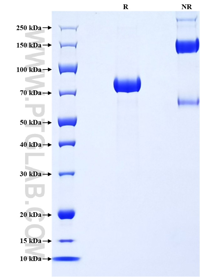 Purity of Recombinant Mouse CD5L was determined by SDS-PAGE. The protein was resolved in an SDS-PAGE in reducing (R) and non-reducing (NR) conditions and stained using Coomassie blue. Purity of Recombinant Mouse CD5L was determined by SDS-PAGE. The protein was resolved in an SDS-PAGE in reducing (R) and non-reducing (NR) conditions and stained using Coomassie blue.