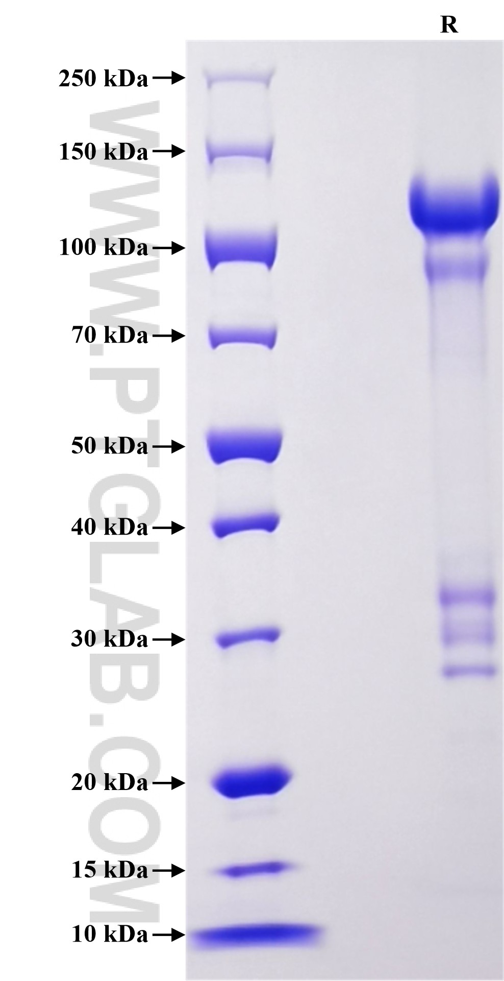 Purity of Recombinant Human CD93 was determined by SDS-PAGE. The protein was resolved in an SDS-PAGE in reducing (R) conditions and stained using Coomassie blue.