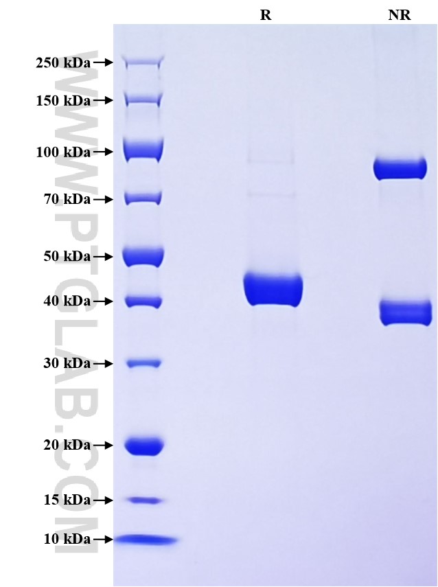 Purity of Recombinant Mouse IL-20 was determined by SDS-PAGE. The protein was resolved in an SDS-PAGE in reducing (R) and non-reducing (NR) conditions and stained using Coomassie blue. Purity of Recombinant Mouse IL-20 was determined by SDS-PAGE. The protein was resolved in an SDS-PAGE in reducing (R) and non-reducing (NR) conditions and stained using Coomassie blue.