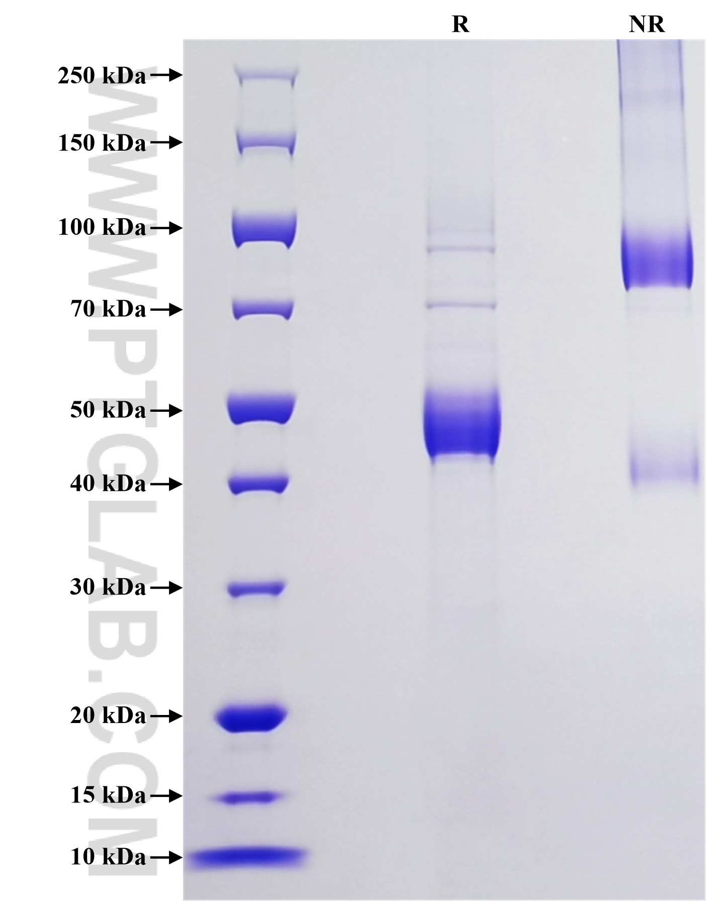 Purity of Recombinant Human IL-25 was determined by SDS-PAGE. The protein was resolved in an SDS-PAGE in reducing (R) and non-reducing (NR) conditions and stained using Coomassie blue. Purity of Recombinant Human IL-25 was determined by SDS-PAGE. The protein was resolved in an SDS-PAGE in reducing (R) and non-reducing (NR) conditions and stained using Coomassie blue.