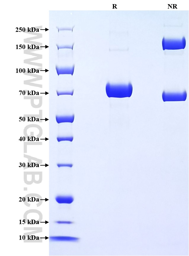 Purity of Recombinant Mouse CHIT1 was determined by SDS-PAGE. The protein was resolved in an SDS-PAGE in reducing (R) and non-reducing (NR) conditions and stained using Coomassie blue. Purity of Recombinant Mouse CHIT1 was determined by SDS-PAGE. The protein was resolved in an SDS-PAGE in reducing (R) and non-reducing (NR) conditions and stained using Coomassie blue.