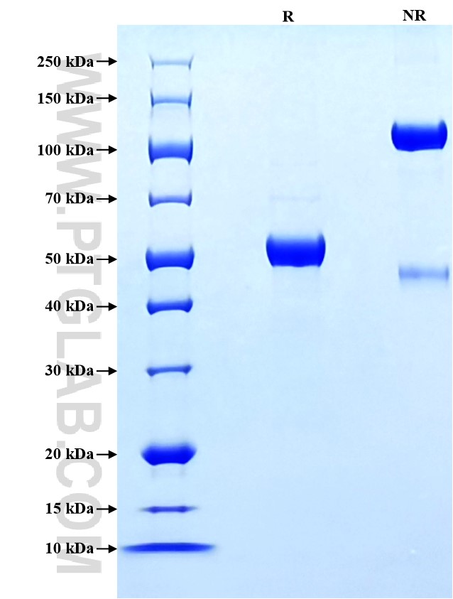 Purity of Recombinant Human ULBP3 was determined by SDS-PAGE. The protein was resolved in an SDS-PAGE in reducing (R) and non-reducing (NR) conditions and stained using Coomassie blue. Purity of Recombinant Human ULBP3 was determined by SDS-PAGE. The protein was resolved in an SDS-PAGE in reducing (R) and non-reducing (NR) conditions and stained using Coomassie blue.