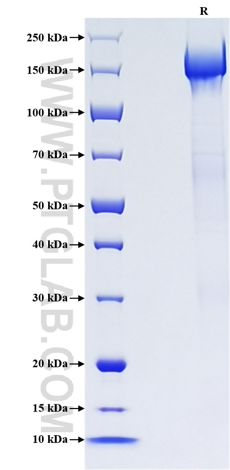 Purity of Recombinant Human PAPPA2 was determined by SDS-PAGE. The protein was resolved in an SDS-PAGE in reducing (R) conditions and stained using Coomassie blue. Purity of Recombinant Human PAPPA2 was determined by SDS-PAGE. The protein was resolved in an SDS-PAGE in reducing (R) conditions and stained using Coomassie blue.