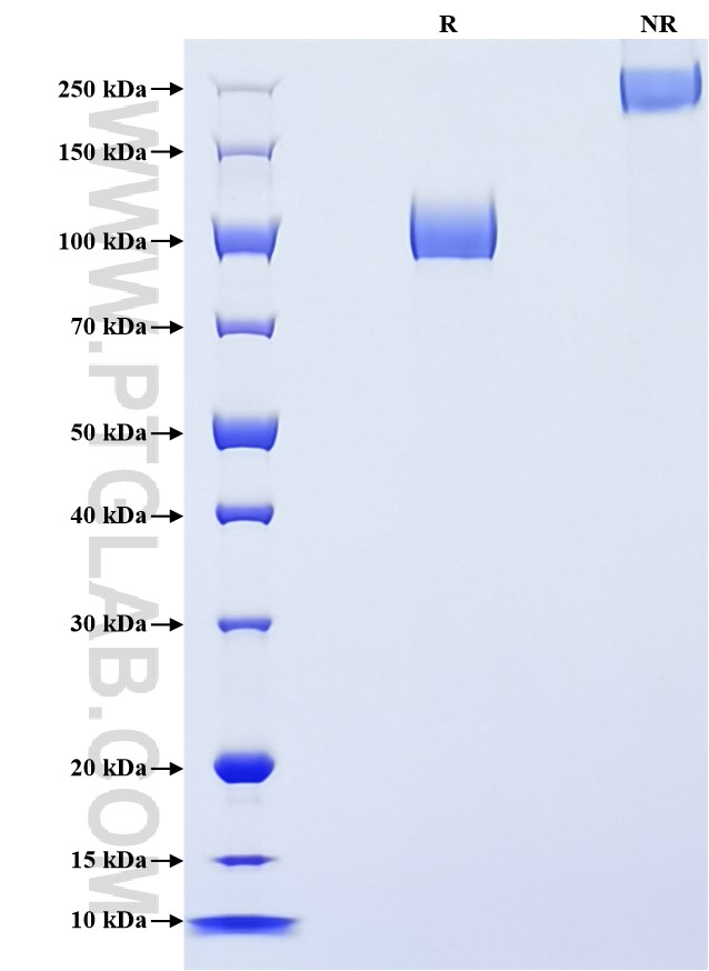 Purity of Recombinant Mouse GPNMB was determined by SDS-PAGE. The protein was resolved in an SDS-PAGE in reducing (R) and non-reducing (NR) conditions and stained using Coomassie blue.