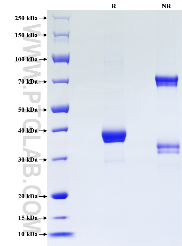 Purity of Recombinant Human CCL13 was determined by SDS-PAGE. The protein was resolved in an SDS-PAGE in reducing (R) and non-reducing (NR) conditions and stained using Coomassie blue. Purity of Recombinant Human CCL13 was determined by SDS-PAGE. The protein was resolved in an SDS-PAGE in reducing (R) and non-reducing (NR) conditions and stained using Coomassie blue.