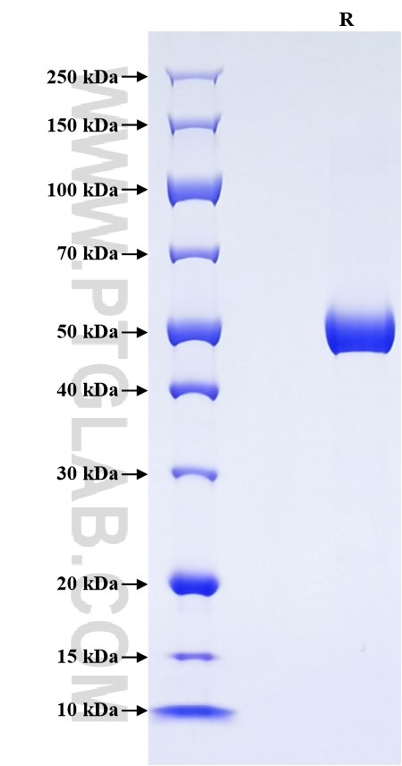 Purity of Recombinant Human CTHRC1 was determined by SDS-PAGE. The protein was resolved in an SDS-PAGE in reducing (R) conditions and stained using Coomassie blue.