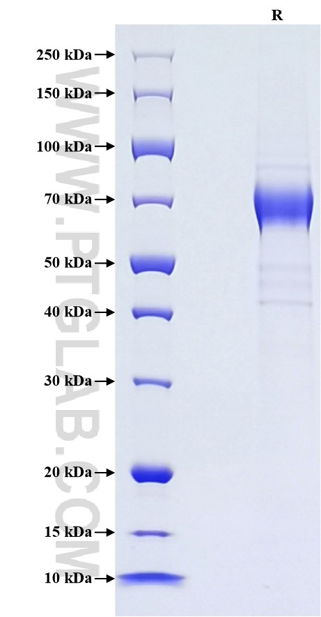 Purity of Recombinant Human IL-22RA2 was determined by SDS-PAGE. The protein was resolved in an SDS-PAGE in reducing (R) conditions and stained using Coomassie blue. Purity of Recombinant Human IL-22RA2 was determined by SDS-PAGE. The protein was resolved in an SDS-PAGE in reducing (R) conditions and stained using Coomassie blue.