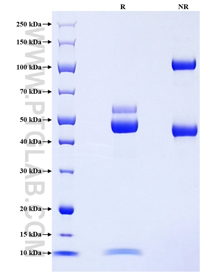 Purity of Recombinant Human KLK6 was determined by SDS-PAGE. The protein was resolved in an SDS-PAGE in reducing (R) and non-reducing (NR) conditions and stained using Coomassie blue.