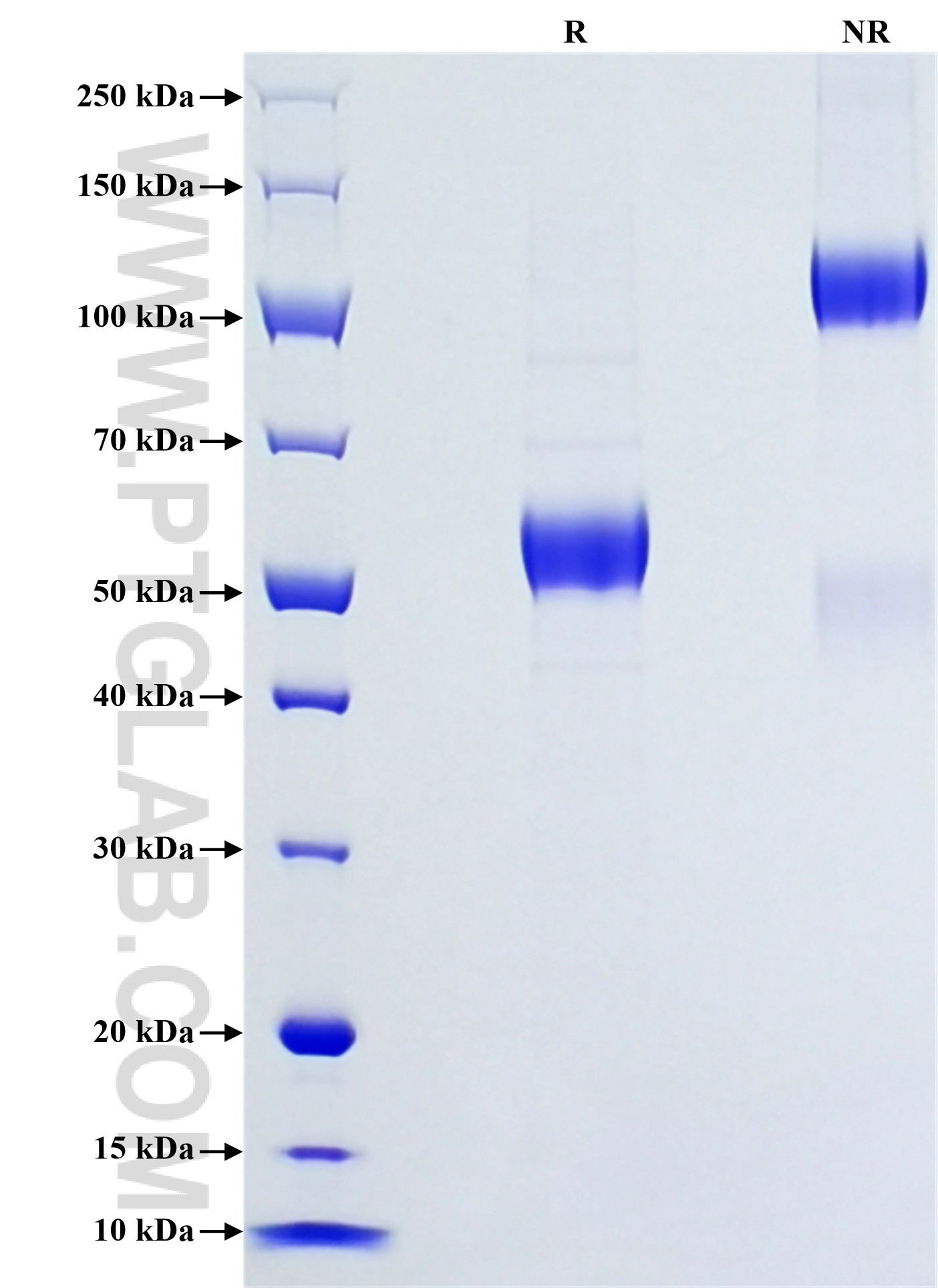 Purity of Recombinant Human IL-29 was determined by SDS-PAGE. The protein was resolved in an SDS-PAGE in reducing (R) and non-reducing (NR) conditions and stained using Coomassie blue.