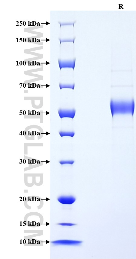 Purity of Recombinant Mouse IL-19 was determined by SDS-PAGE. The protein was resolved in an SDS-PAGE in reducing (R) conditions and stained using Coomassie blue. Purity of Recombinant Mouse IL-19 was determined by SDS-PAGE. The protein was resolved in an SDS-PAGE in reducing (R) conditions and stained using Coomassie blue.