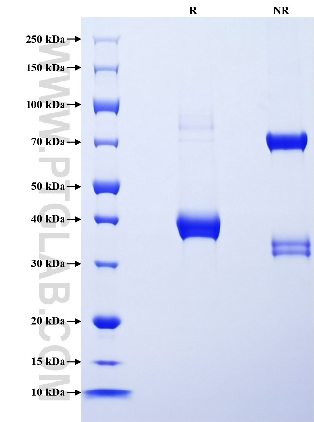 Purity of Recombinant Mouse CXCL16 was determined by SDS-PAGE. The protein was resolved in an SDS-PAGE in reducing (R) and non-reducing (NR) conditions and stained using Coomassie blue. Purity of Recombinant Mouse CXCL16 was determined by SDS-PAGE. The protein was resolved in an SDS-PAGE in reducing (R) and non-reducing (NR) conditions and stained using Coomassie blue.