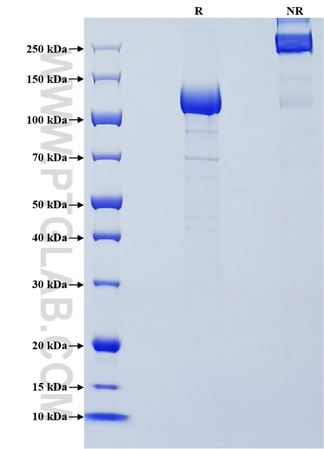 Purity of Recombinant Human LRIG3 was determined by SDS-PAGE. The protein was resolved in an SDS-PAGE in reducing (R) and non-reducing (NR) conditions and stained using Coomassie blue.