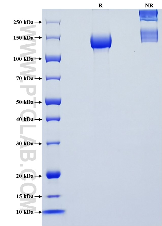 Purity of Recombinant Mouse CACHD1 was determined by SDS-PAGE. The protein was resolved in an SDS-PAGE in reducing (R) and non-reducing (NR) conditions and stained using Coomassie blue. Purity of Recombinant Mouse CACHD1 was determined by SDS-PAGE. The protein was resolved in an SDS-PAGE in reducing (R) and non-reducing (NR) conditions and stained using Coomassie blue.
