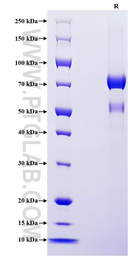 Purity of Recombinant Mouse NOV was determined by SDS-PAGE. The protein was resolved in an SDS-PAGE in reducing (R) conditions and stained using Coomassie blue.
