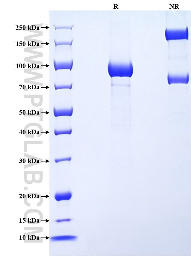 Purity of Recombinant Mouse Epha6 was determined by SDS-PAGE. The protein was resolved in an SDS-PAGE in reducing (R) and non-reducing (NR) conditions and stained using Coomassie blue. Purity of Recombinant Mouse Epha6 was determined by SDS-PAGE. The protein was resolved in an SDS-PAGE in reducing (R) and non-reducing (NR) conditions and stained using Coomassie blue.