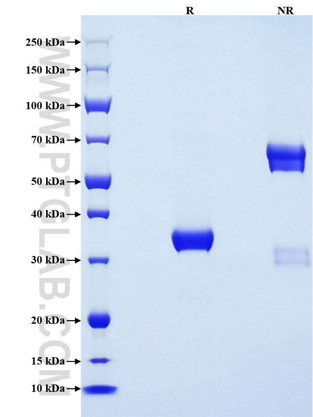 Purity of Recombinant Mouse Ereg was determined by SDS-PAGE. The protein was resolved in an SDS-PAGE in reducing (R) and non-reducing (NR) conditions and stained using Coomassie blue. Purity of Recombinant Mouse Ereg was determined by SDS-PAGE. The protein was resolved in an SDS-PAGE in reducing (R) and non-reducing (NR) conditions and stained using Coomassie blue.