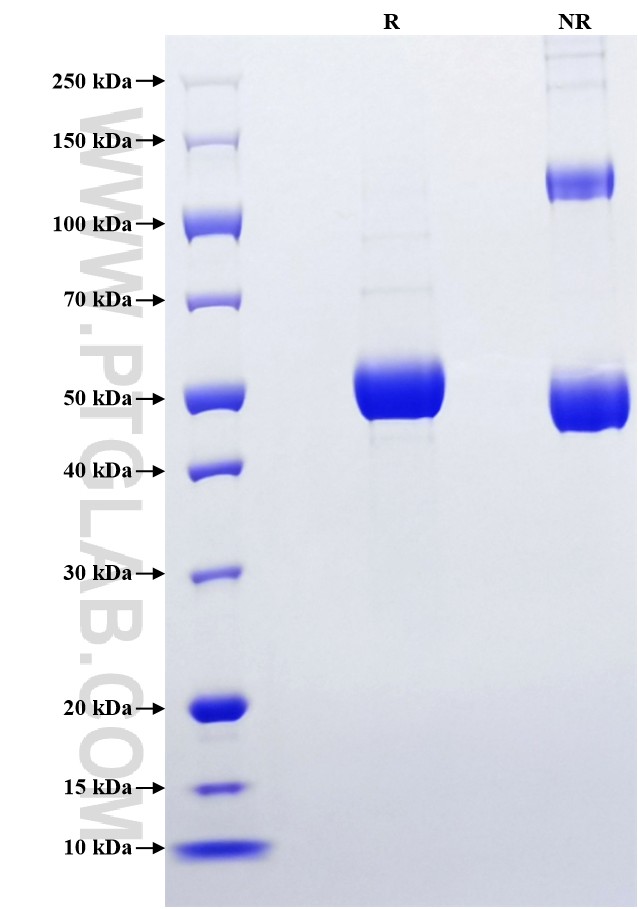 Purity of Recombinant Mouse Ctf1 was determined by SDS-PAGE. The protein was resolved in an SDS-PAGE in reducing (R) and non-reducing (NR) conditions and stained using Coomassie blue.