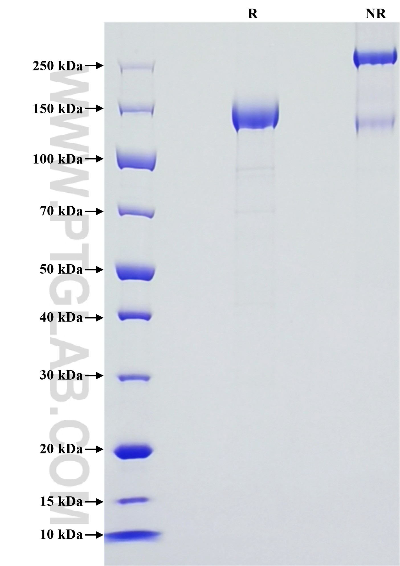 Purity of Recombinant Mouse ICAM5 was determined by SDS-PAGE. The protein was resolved in an SDS-PAGE in reducing (R) and non-reducing (NR) conditions and stained using Coomassie blue. Purity of Recombinant Mouse ICAM5 was determined by SDS-PAGE. The protein was resolved in an SDS-PAGE in reducing (R) and non-reducing (NR) conditions and stained using Coomassie blue.
