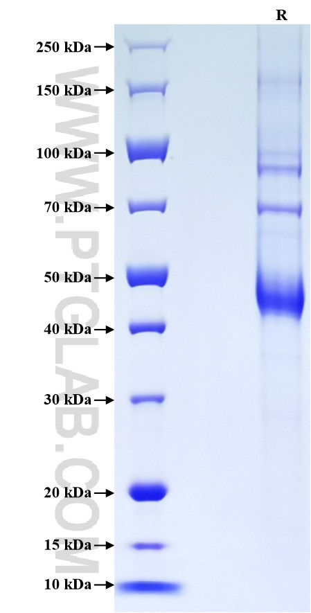 Purity of Recombinant Human TNFSF12 was determined by SDS-PAGE. The protein was resolved in an SDS-PAGE in reducing (R) conditions and stained using Coomassie blue. Purity of Recombinant Human TNFSF12 was determined by SDS-PAGE. The protein was resolved in an SDS-PAGE in reducing (R) conditions and stained using Coomassie blue.