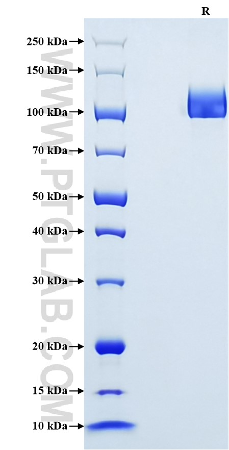 Purity of Recombinant Human Meprin beta Subunit was determined by SDS-PAGE. The protein was resolved in an SDS-PAGE in reducing (R) conditions and stained using Coomassie blue.
