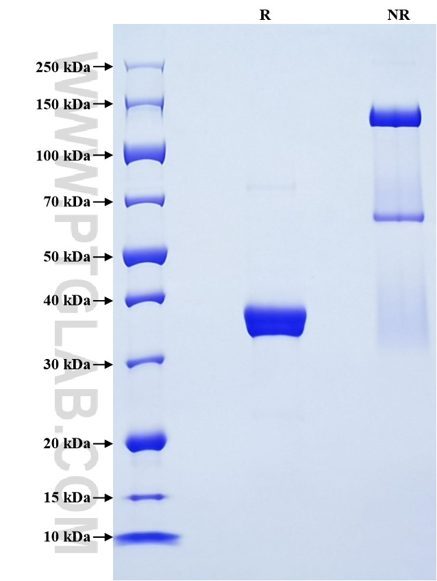 Purity of Recombinant Human CCL14 was determined by SDS-PAGE. The protein was resolved in an SDS-PAGE in reducing (R) and non-reducing (NR) conditions and stained using Coomassie blue. Purity of Recombinant Human CCL14 was determined by SDS-PAGE. The protein was resolved in an SDS-PAGE in reducing (R) and non-reducing (NR) conditions and stained using Coomassie blue.
