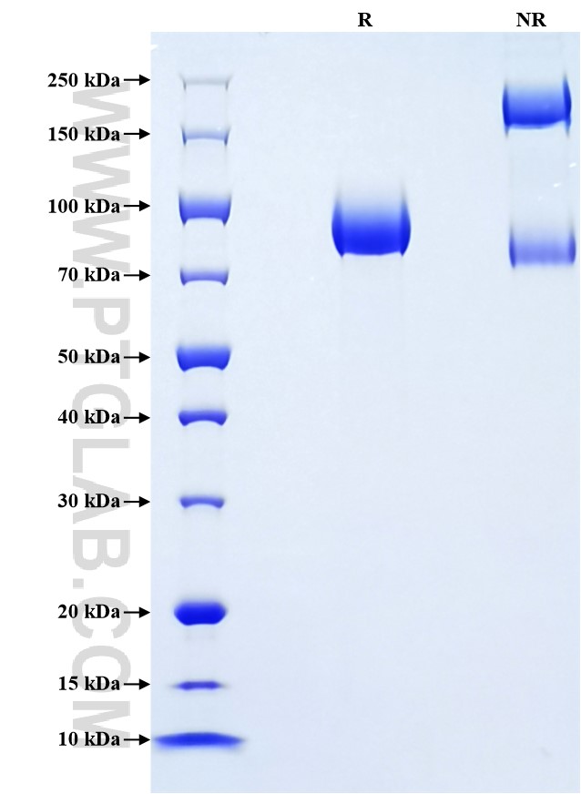 Purity of Recombinant Human TrkB was determined by SDS-PAGE. The protein was resolved in an SDS-PAGE in reducing (R) and non-reducing (NR) conditions and stained using Coomassie blue. Purity of Recombinant Human TrkB was determined by SDS-PAGE. The protein was resolved in an SDS-PAGE in reducing (R) and non-reducing (NR) conditions and stained using Coomassie blue.