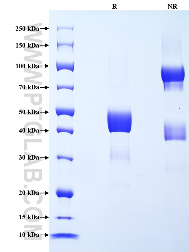 Purity of Recombinant Human PRR4 was determined by SDS-PAGE. The protein was resolved in an SDS-PAGE in reducing (R) and non-reducing (NR) conditions and stained using Coomassie blue.