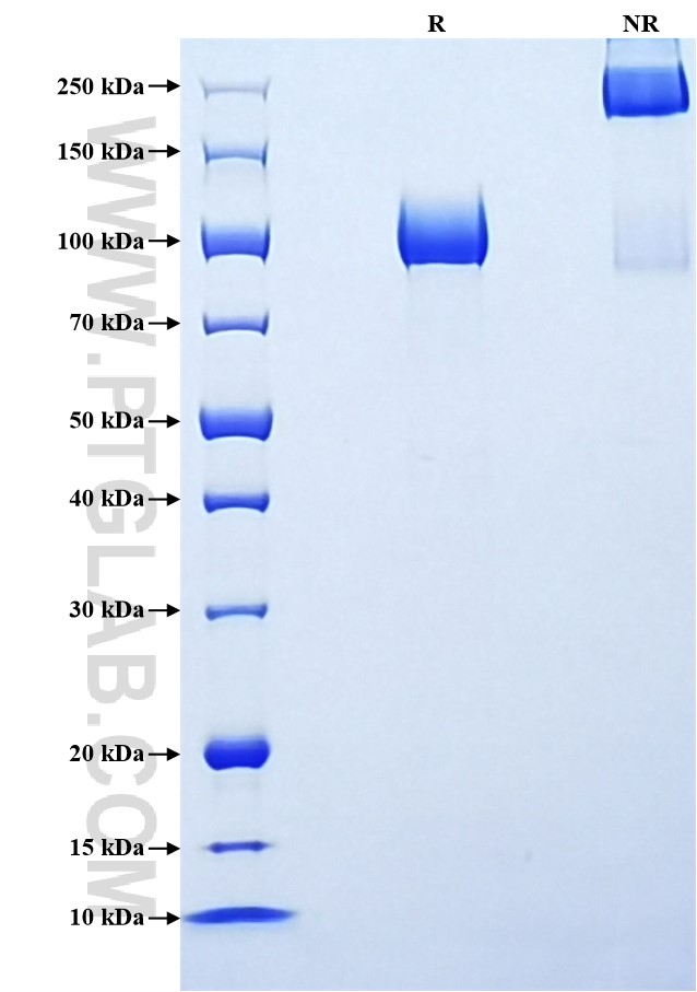Purity of Recombinant Human GPNMB was determined by SDS-PAGE. The protein was resolved in an SDS-PAGE in reducing (R) and non-reducing (NR) conditions and stained using Coomassie blue.