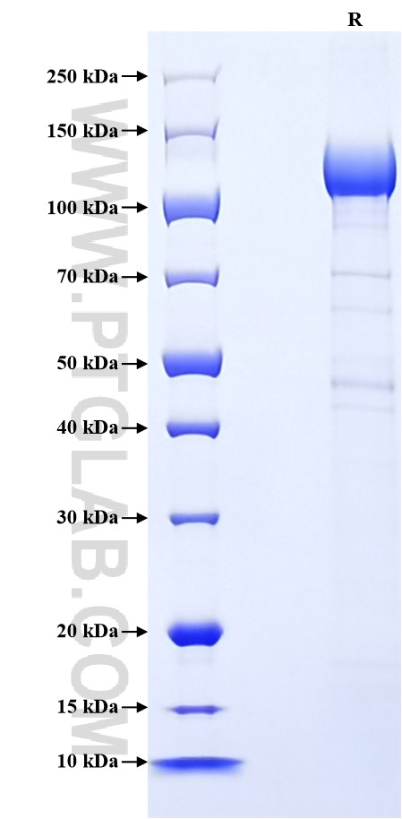 Purity of Recombinant Human Cadherin-17 was determined by SDS-PAGE. The protein was resolved in an SDS-PAGE in reducing (R) conditions and stained using Coomassie blue. Purity of Recombinant Human Cadherin-17 was determined by SDS-PAGE. The protein was resolved in an SDS-PAGE in reducing (R) conditions and stained using Coomassie blue.