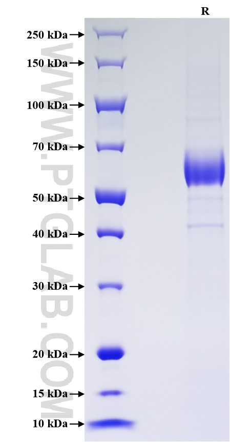 Purity of Recombinant Human KLK11 was determined by SDS-PAGE. The protein was resolved in an SDS-PAGE in reducing (R) conditions and stained using Coomassie blue.