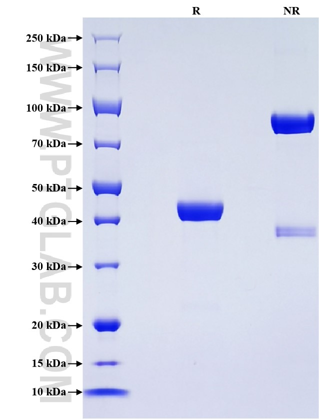 Purity of Recombinant Human REG3A was determined by SDS-PAGE. The protein was resolved in an SDS-PAGE in reducing (R) and non-reducing (NR) conditions and stained using Coomassie blue.