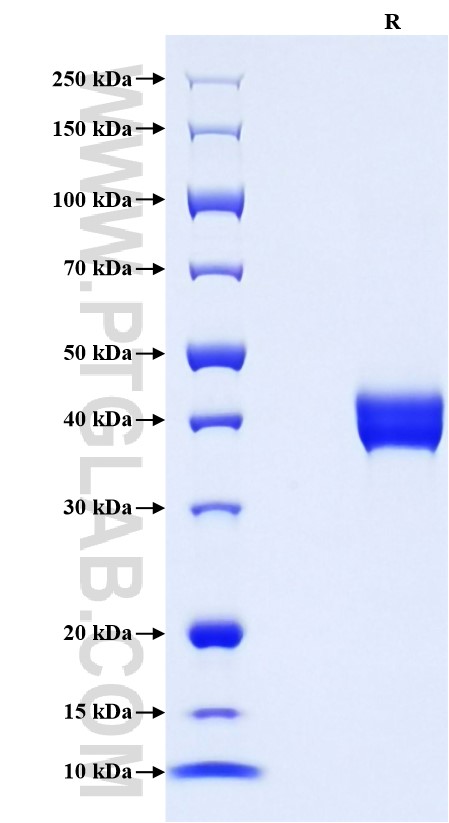 Purity of Recombinant Human TFF2 was determined by SDS-PAGE. The protein was resolved in an SDS-PAGE in reducing (R) conditions and stained using Coomassie blue.