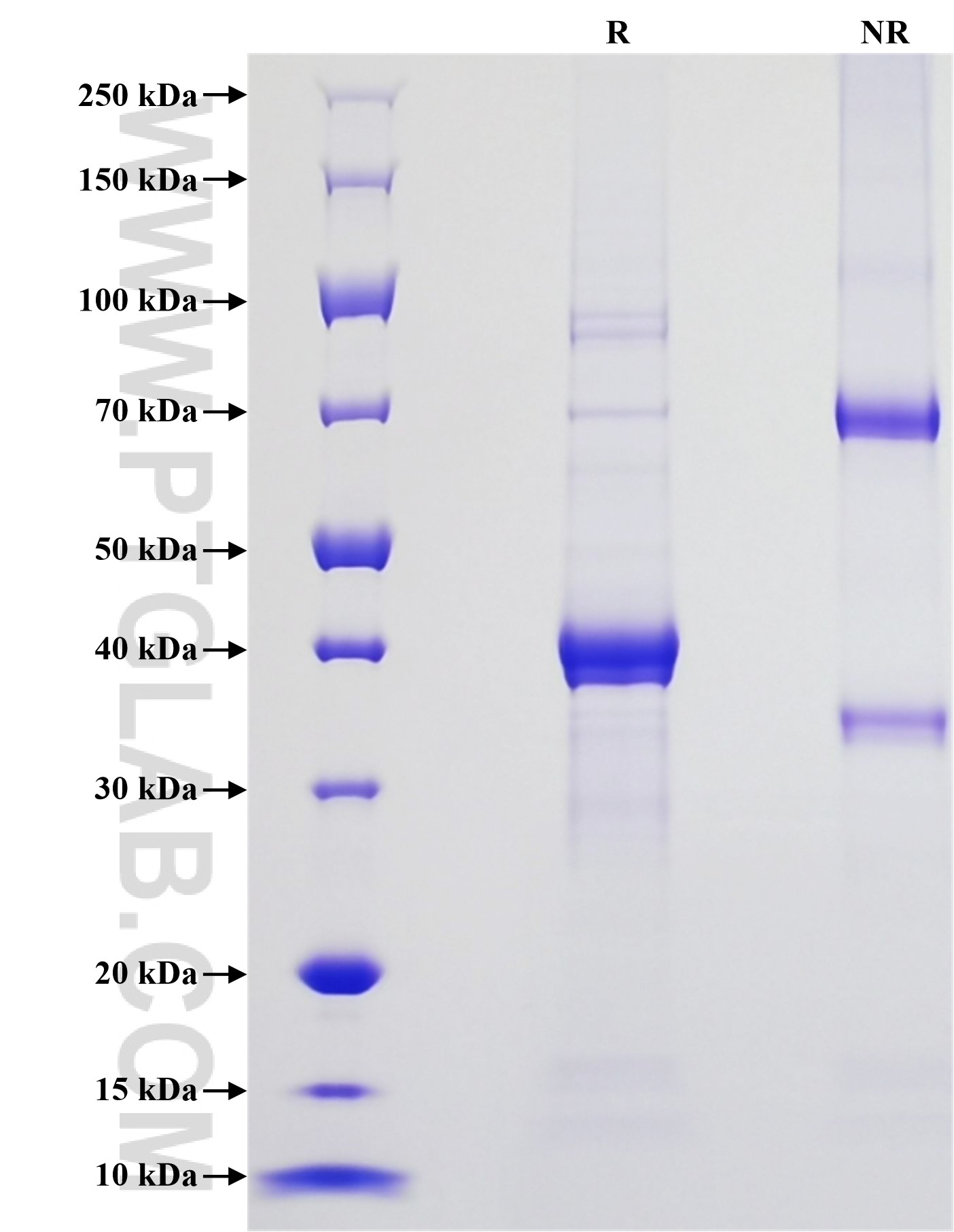Purity of Recombinant Mouse SLPI was determined by SDS-PAGE. The protein was resolved in an SDS-PAGE in reducing (R) and non-reducing (NR) conditions and stained using Coomassie blue. Purity of Recombinant Mouse SLPI was determined by SDS-PAGE. The protein was resolved in an SDS-PAGE in reducing (R) and non-reducing (NR) conditions and stained using Coomassie blue.