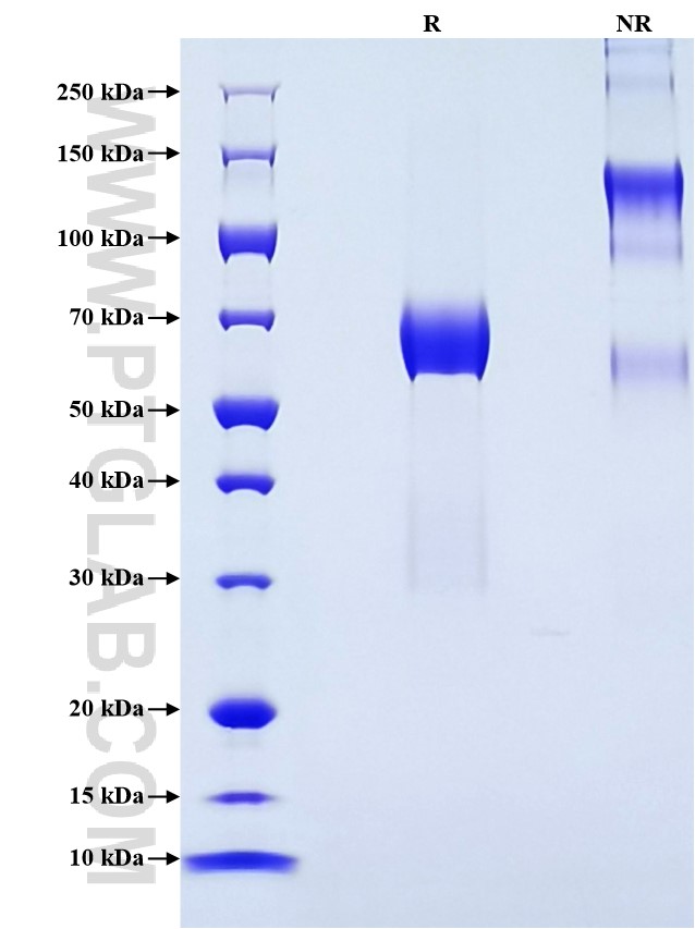 Purity of Recombinant Human DLK1 was determined by SDS-PAGE. The protein was resolved in an SDS-PAGE in reducing (R) and non-reducing (NR) conditions and stained using Coomassie blue.
