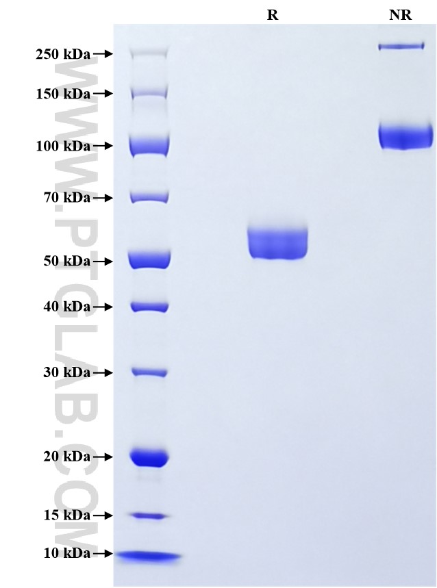 Purity of Recombinant Human OLR1 was determined by SDS-PAGE. The protein was resolved in an SDS-PAGE in reducing (R) and non-reducing (NR) conditions and stained using Coomassie blue. Purity of Recombinant Human OLR1 was determined by SDS-PAGE. The protein was resolved in an SDS-PAGE in reducing (R) and non-reducing (NR) conditions and stained using Coomassie blue.