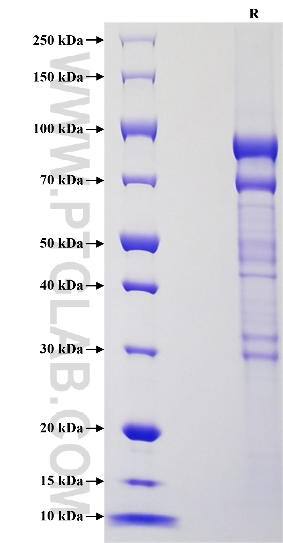 Purity of Recombinant Human ADAM8 was determined by SDS-PAGE. The protein was resolved in an SDS-PAGE in reducing (R) conditions and stained using Coomassie blue. Purity of Recombinant Human ADAM8 was determined by SDS-PAGE. The protein was resolved in an SDS-PAGE in reducing (R) conditions and stained using Coomassie blue.