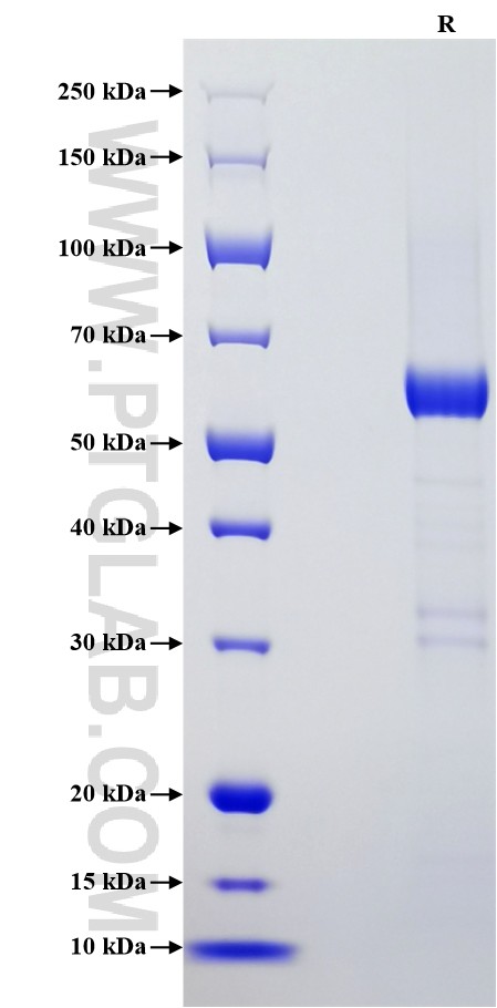 Purity of Recombinant Human GAS1 was determined by SDS-PAGE. The protein was resolved in an SDS-PAGE in reducing (R) conditions and stained using Coomassie blue.