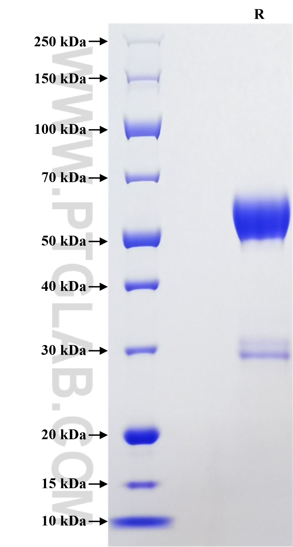 Purity of Recombinant Mouse Oncostatin M was determined by SDS-PAGE. The protein was resolved in an SDS-PAGE in reducing (R) conditions and stained using Coomassie blue.