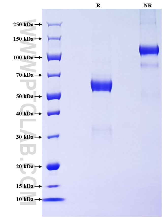 Purity of Recombinant Human STC1 was determined by SDS-PAGE. The protein was resolved in an SDS-PAGE in reducing (R) and non-reducing (NR) conditions and stained using Coomassie blue. Purity of Recombinant Human STC1 was determined by SDS-PAGE. The protein was resolved in an SDS-PAGE in reducing (R) and non-reducing (NR) conditions and stained using Coomassie blue.
