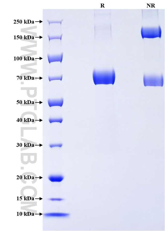 Purity of Recombinant Human Lumican was determined by SDS-PAGE. The protein was resolved in an SDS-PAGE in reducing (R) and non-reducing (NR) conditions and stained using Coomassie blue.