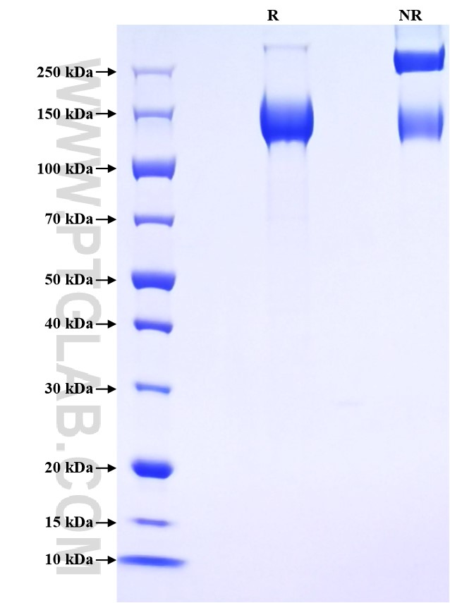 Purity of Recombinant Mouse Lepr was determined by SDS-PAGE. The protein was resolved in an SDS-PAGE in reducing (R) and non-reducing (NR) conditions and stained using Coomassie blue. Purity of Recombinant Mouse Lepr was determined by SDS-PAGE. The protein was resolved in an SDS-PAGE in reducing (R) and non-reducing (NR) conditions and stained using Coomassie blue.