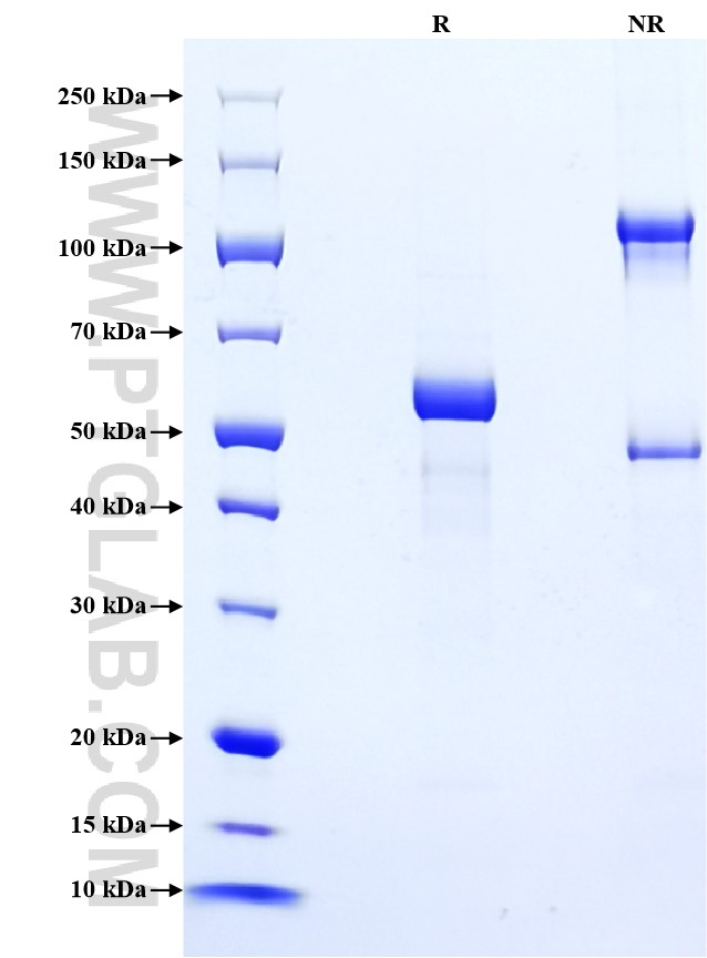 Purity of Recombinant Mouse IGFBP1 was determined by SDS-PAGE. The protein was resolved in an SDS-PAGE in reducing (R) and non-reducing (NR) conditions and stained using Coomassie blue.