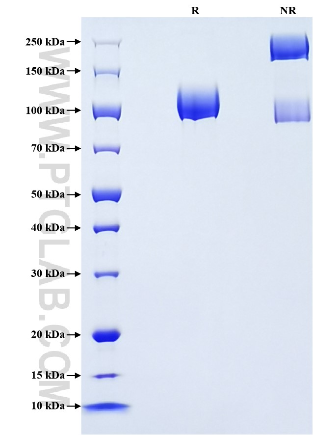 Purity of Recombinant Human CD146 was determined by SDS-PAGE. The protein was resolved in an SDS-PAGE in reducing (R) and non-reducing (NR) conditions and stained using Coomassie blue.